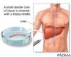 liver.jpg