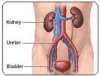 kidneyi.jpeg