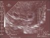 wbwtwins4-8-1.jpg