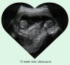 wbwtwins12-16-1.jpg