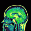 brainAnimation.gif